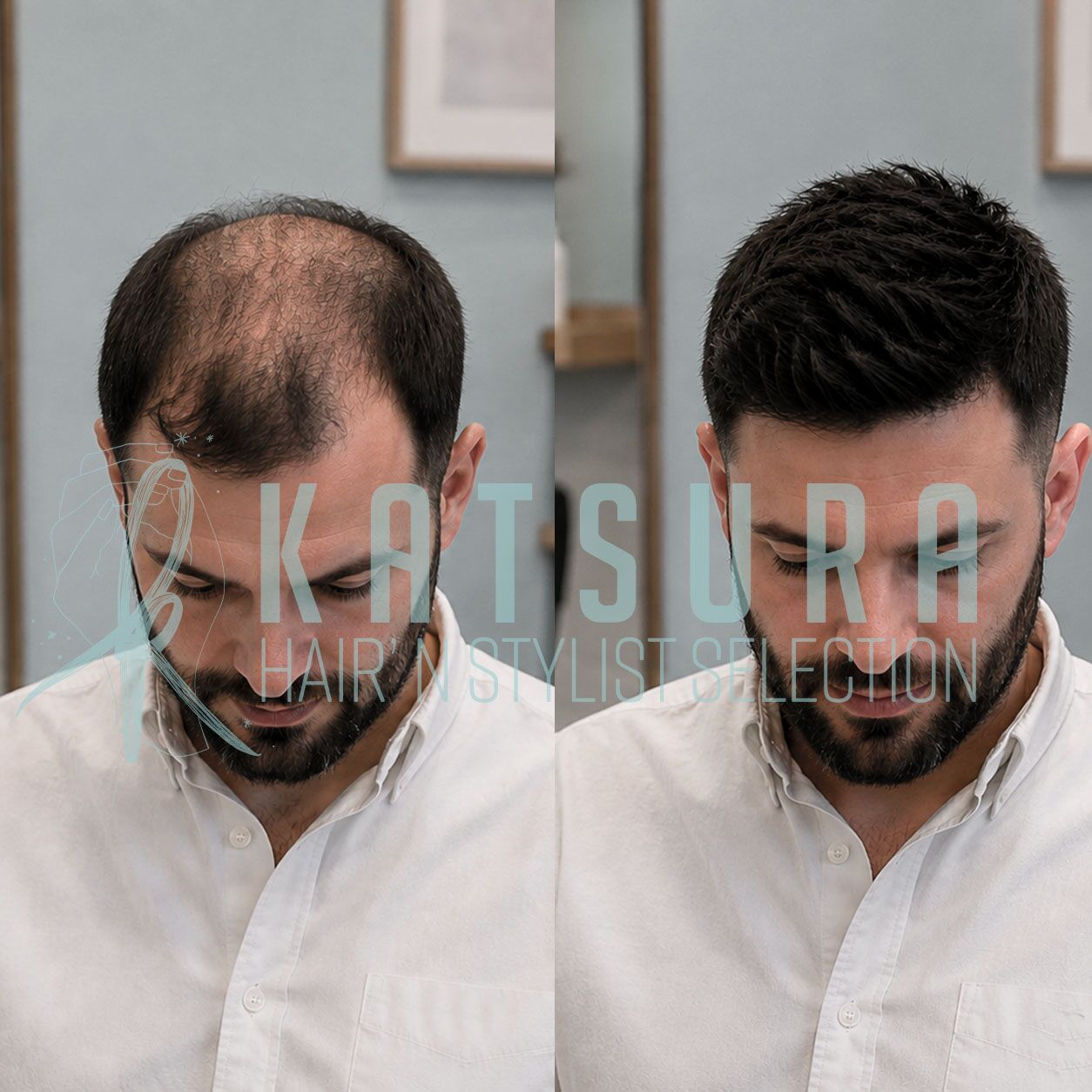 Bruce + Complément capillaire 0,06 mm 120% 14 Bruce 120%complément capillaire solution contre la perte de cheveux calvitie postiche homme